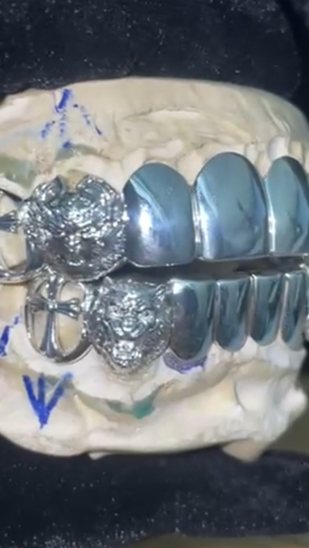 Custom 925 Silver Grillz
